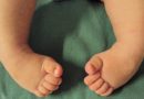 Agora é Lei: Exame para diagnóstico do Pé Torto Congênito em recém-nascidos deverá ser oferecido em Hospitais Públicos