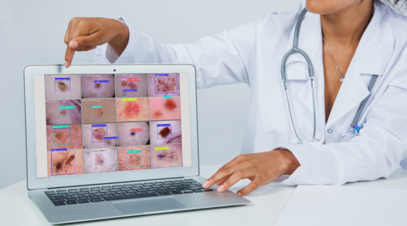 Modelo de IA apoia diagnóstico de câncer de pele