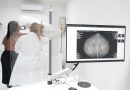 Mais uma unidade de saúde de São Gonçalo passa a fazer exames de mamografia