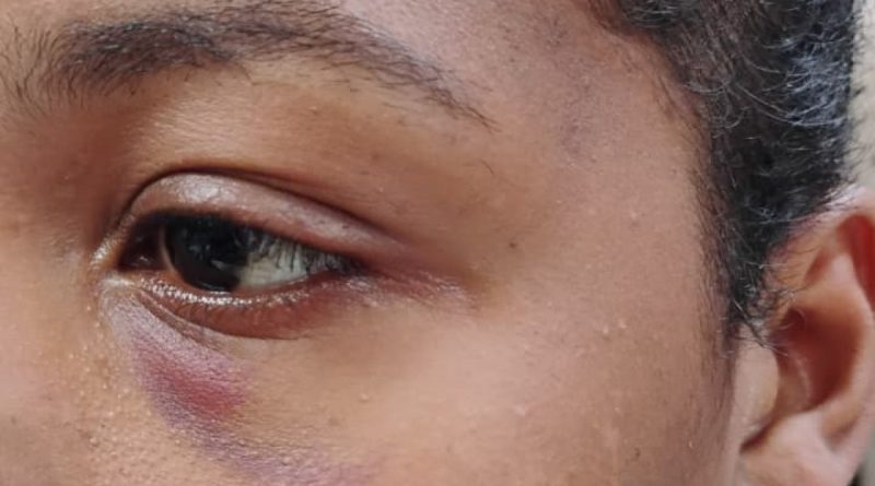 Homem é preso por manter mulher em cárcere privado sob tortura em Nova Iguaçu