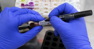 Exame testa negativo para ebola em paciente que chegou ao Rio após viagem pela África