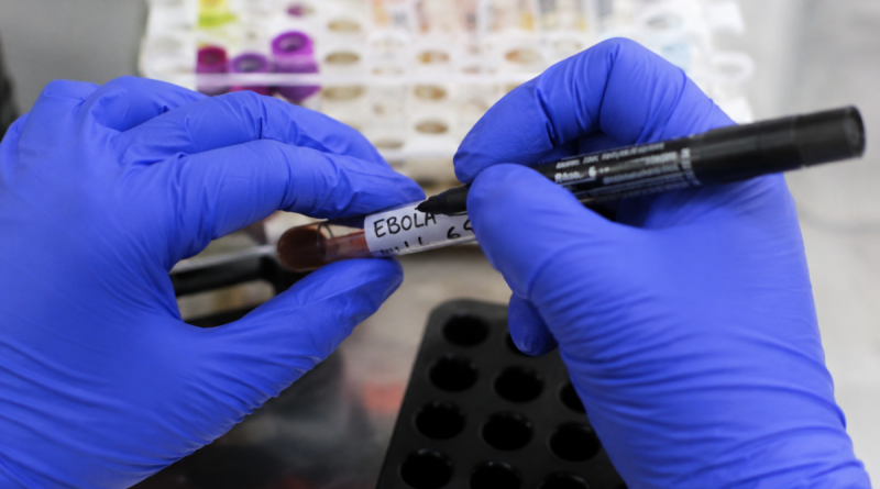 Exame testa negativo para ebola em paciente que chegou ao Rio após viagem pela África