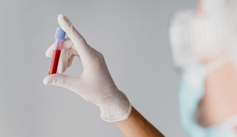 Hantavírus: infectologista da HU Brasil explica transmissão, sintomas e prevenção