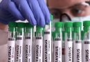 Paraná confirma dois casos de hantavírus e investiga outros 11; entenda doença e como identificar sintomas
