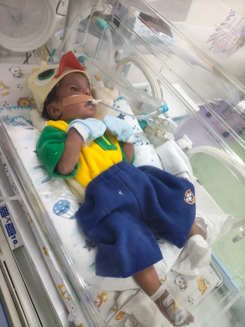 Hospital Estadual Azevedo Lima promove ações de humanização para bebês internados na UTI Neonatal