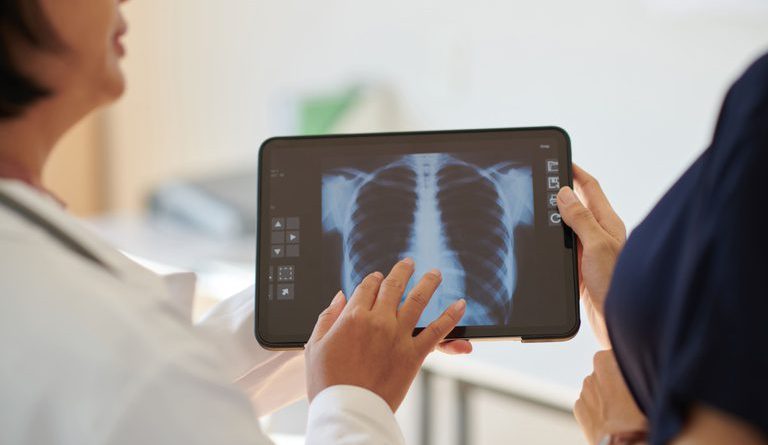 Anvisa aprova medicamento para hipertensão pulmonar