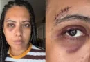 Influenciadora é agredida em samba na Lapa; advogada diz que agressor saiu rindo e debochando