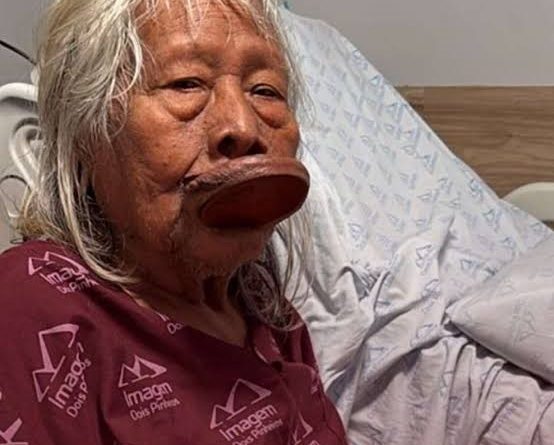 Cacique Raoni é diagnosticado com câncer