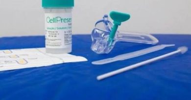 Rio de Janeiro tem 37 municípios com teste molecular para detecção precoce do câncer do colo do útero pelo SUS